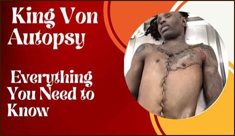 Discover The Shocking Truth: King Von's Autopsy Photos Revealed